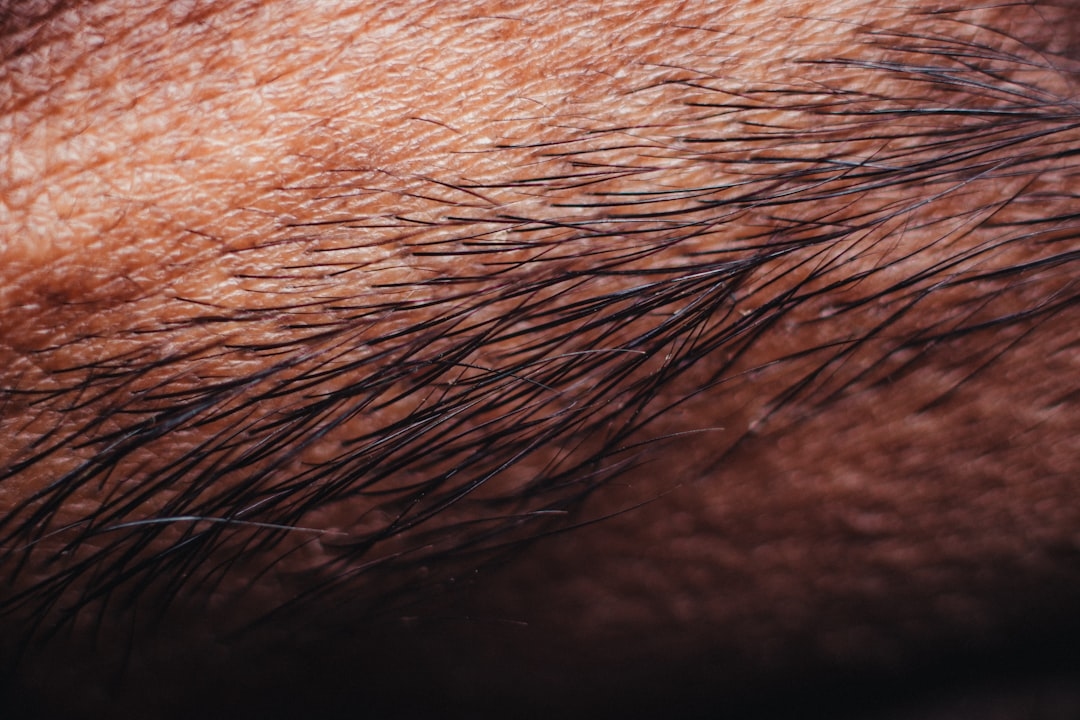 How to Get Rid of Chin Hair Permanently: A Complete Guide to Your Options